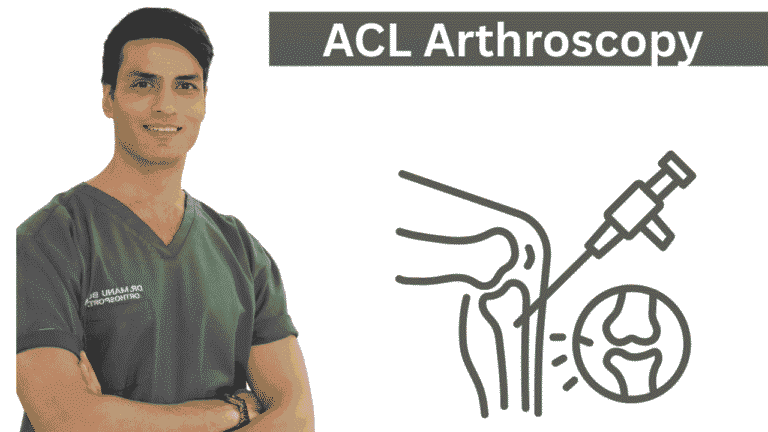 ACL Arthroscopy