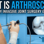What Is Arthroscopy?