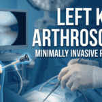 Left Knee Arthroscopy