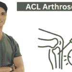 ACL Arthroscopy