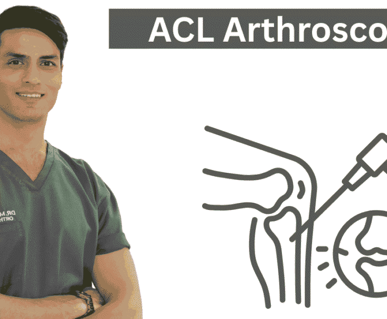 ACL Arthroscopy