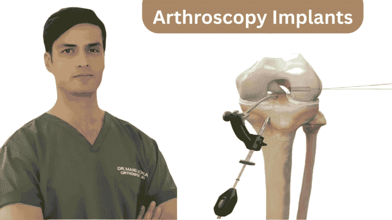 Arthroscopy Implants for Faster and Safer Knee Recovery