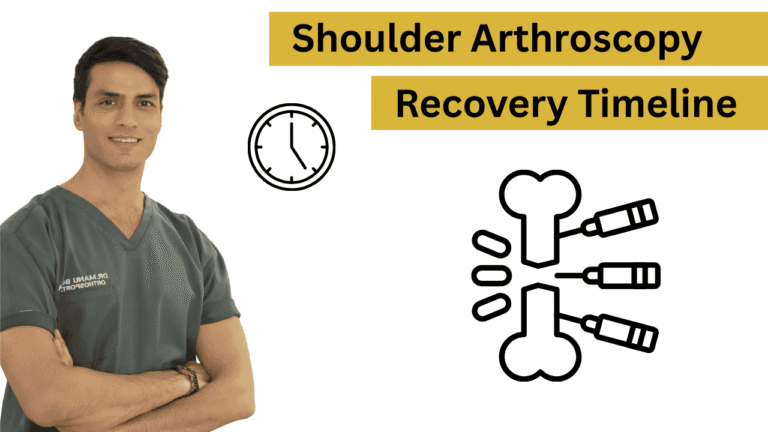 Shoulder Arthroscopy Recovery Timeline