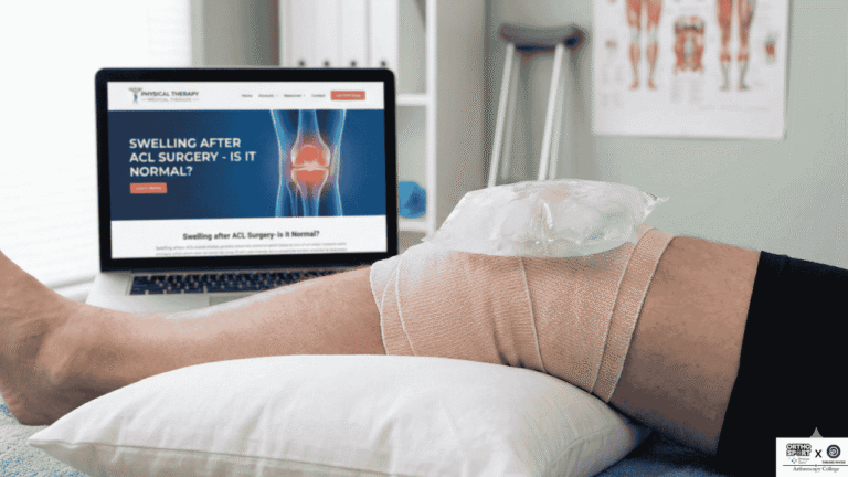 Swelling After ACL Surgery