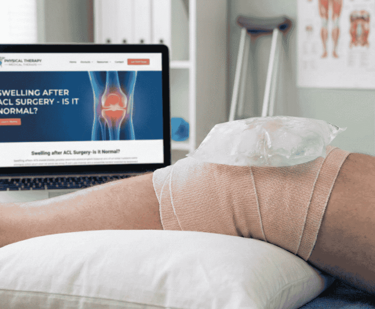 Swelling After ACL Surgery