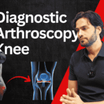 Diagnostic Arthroscopy Knee
