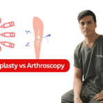 Arthroplasty vs Arthroscopy
