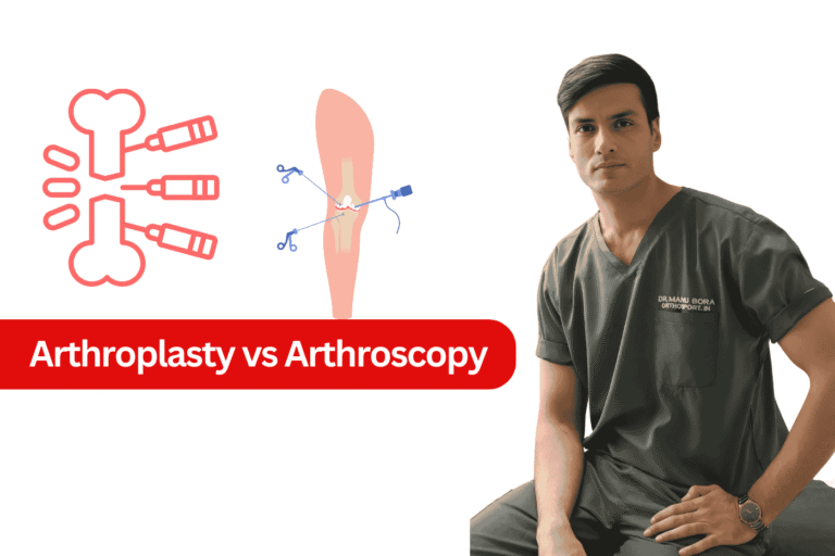 Arthroplasty vs Arthroscopy
