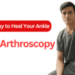 Ankle Arthroscopy