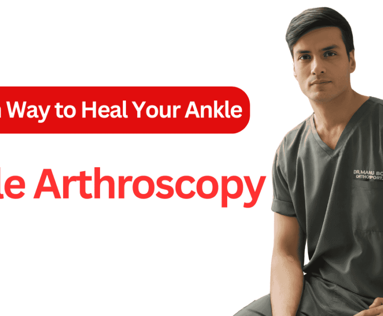 Ankle Arthroscopy