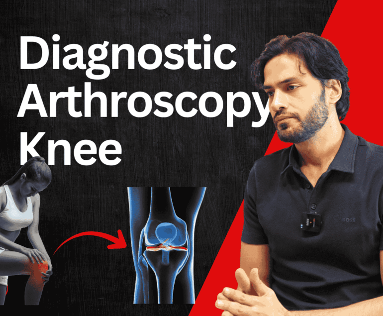 Diagnostic Arthroscopy Knee
