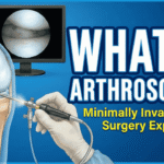 What is arthroscopy